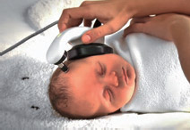 screening device on newborn head